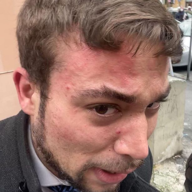 Colluttazione con gli agenti della polizia locale, c'è la versione del giovane: &quot;Scaraventato a terra, hanno cancellato il video della loro aggressione&quot;