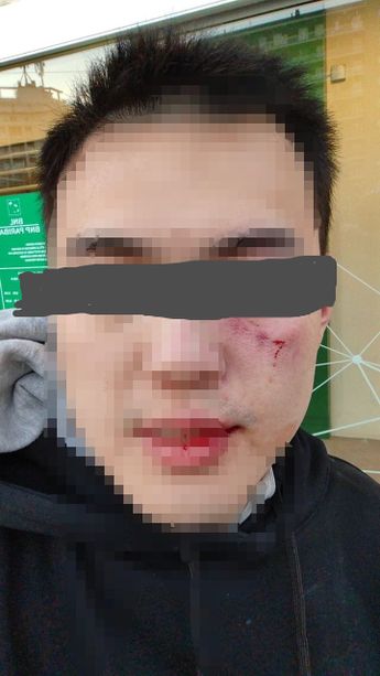 Studente universitario cinese aggredito e picchiato sulla metropolitana il giorno di Natale Studente universitario cinese aggredito e picchiato sulla metropolitana il giorno di Natale