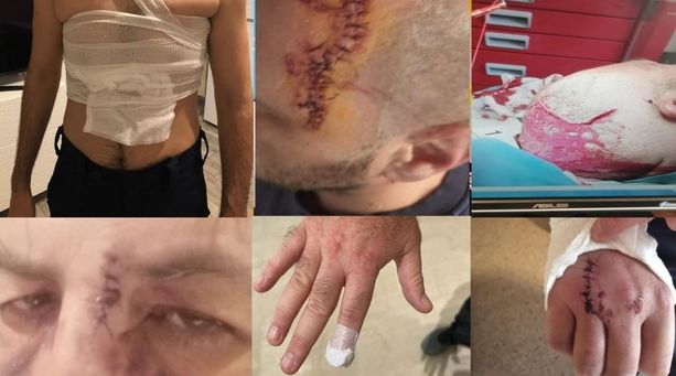 Aggrediti con mattoni, allarme dei sindacati di polizia: "Massacrati dai detenuti. Il carcere di Torino non è una discarica sociale" Aggrediti con mattoni, allarme dei sindacati di polizia: "Massacrati dai detenuti. Il carcere di Torino non è una discarica sociale"