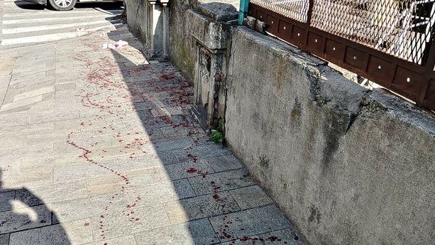 Accoltellamento a Villapiana, l'aggressore sarebbe stato individuato dalla polizia