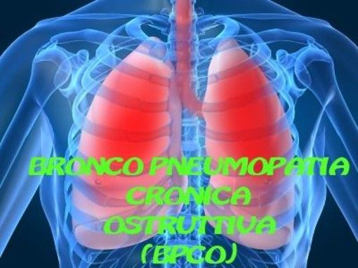 La nuova terapia contro la Broncopneumopatia è quasi una rivoluzione La nuova terapia contro la Broncopneumopatia è quasi una rivoluzione