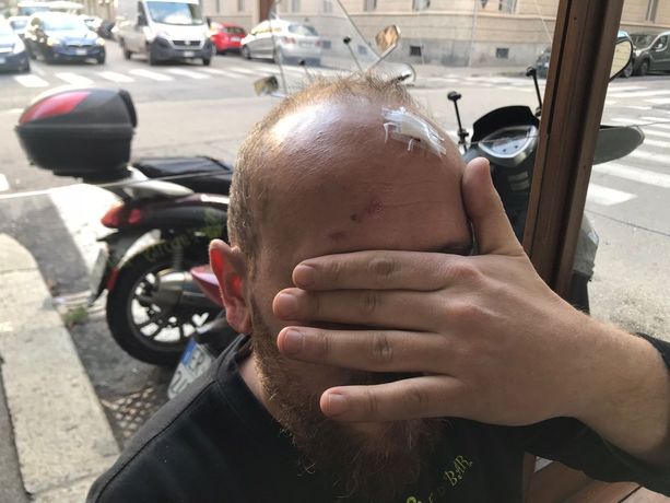 Picchiato da 15 anarchici, il racconto del barista: “Siamo in mano a gentaglia che fa quello che vuole” [VIDEO]