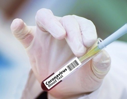 Coronavirus, in Piemonte un positivo su due ha la variante inglese del virus