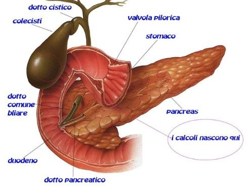 I calcoli alla cistifellea riguardano l’8% della popolazione dopo i quarant’anni