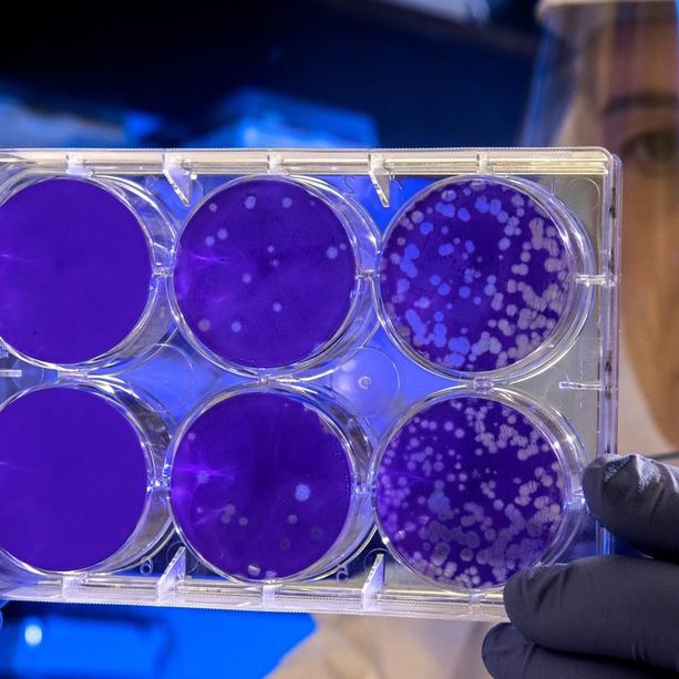 Coronavirus, nessun nuovo decesso in Piemonte. Altri 38 positivi