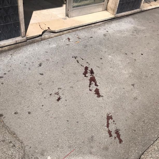 Misteriosa sparatoria in corso Casale ad Asti. Un ferito