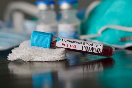 Covid: in Liguria 395 positivi nelle ultime ventiquattr'ore, 148 a Genova