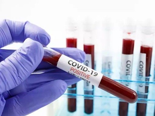 Obbligo di autodenuncia per chi proviene dai paesi a rischio Covid-19 e isolamento fino al risultato del tampone