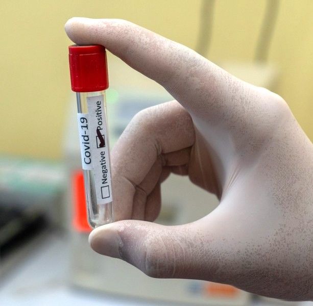 Coronavirus, dati ancora in discesa in tutta la Liguria: in provincia di Genova 41 contagi. Tasso di positività al 2,02%