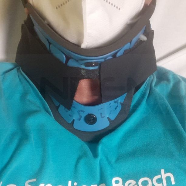 Ospedaletti: diverbio per la spiaggia per cani, titolare della Scogliera spintonato dal Sindaco finisce in ospedale