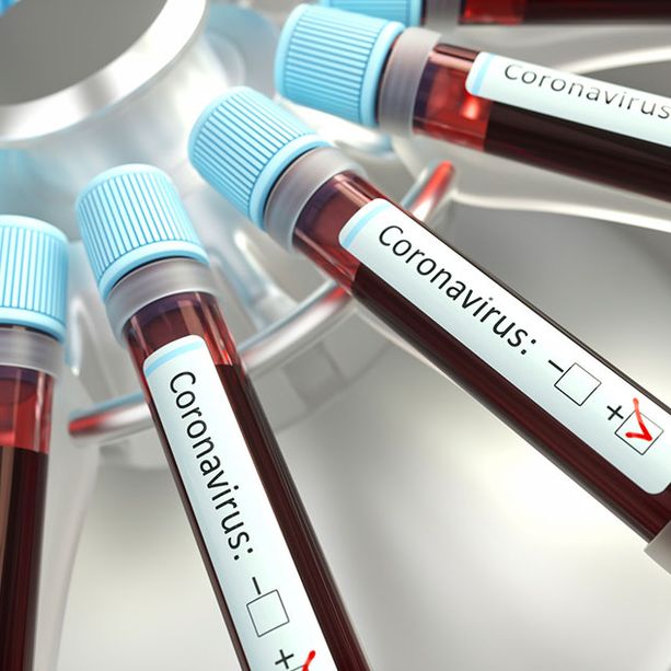 Covid in Liguria: 17 nuovi positivi in provincia di Imperia, morto uomo ricoverato a Sanremo