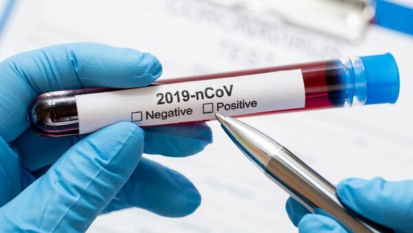 Covid, in provincia di Imperia oggi 289 nuovi casi positivi. 14 le vittime in tutta la Liguria