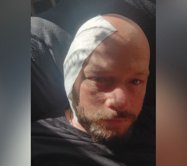 Cane azzanna un carabiniere e gli mutila un orecchio nel centro di Alassio