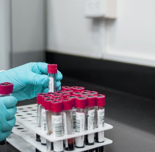 Coronavirus, 3.066 i nuovi positivi registrati in Liguria