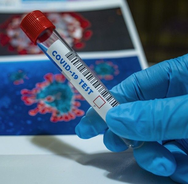 Covid, in Piemonte altri 29 decessi e quasi 3.200 contagiati. I letti occupati in terapia intensiva sfondano quota 200