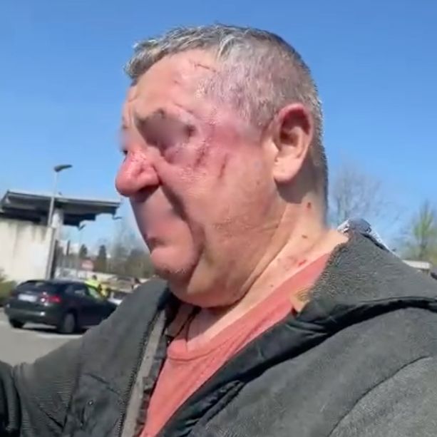 Rapina al suk della Colletta: uomo di 57 anni cade e viene derubato. Portato al Giovanni Bosco
