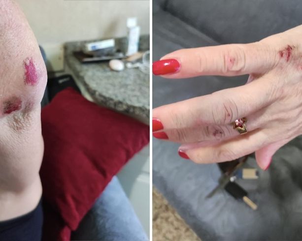 Gettata a terra per una borsa, donna aggredita in Barriera di Milano: “Ora ho paura ad uscire di casa”