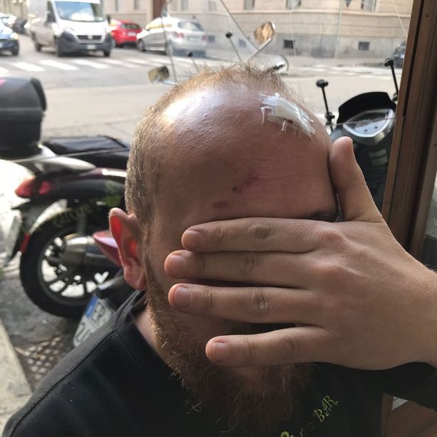 Picchiato da 15 anarchici, il racconto del barista: “Siamo in mano a gentaglia che fa quello che vuole” [VIDEO]