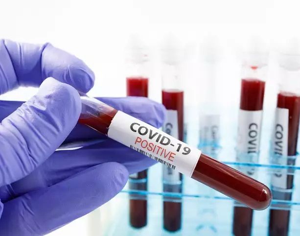 Il Covid rialza lentamente la testa: invariate le terapie intensive, crescono ancora i ricoveri