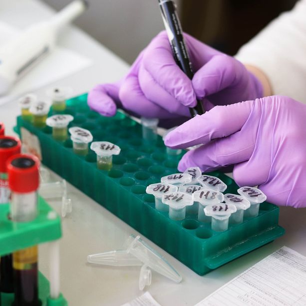 Coronavirus, continuano a crescere i casi positivi in Piemonte, ma diminuiscono i ricoverati in ospedale