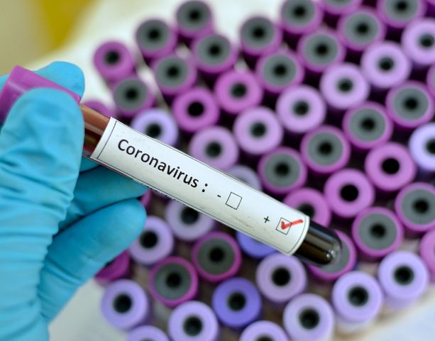 Coronavirus, 71 i decessi comunicati oggi. Sfiorano quota 3000 i pazienti guariti