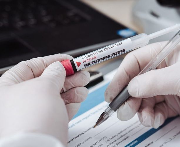 Coronavirus, altri 32 morti in Piemonte. Ma il totale dei guariti sfiora quota 10 mila