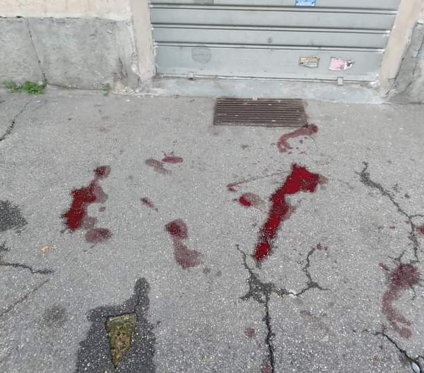Sangue sulle strade di Mirafiori Nord: aggressione a colpi di machete, la vittima in ospedale