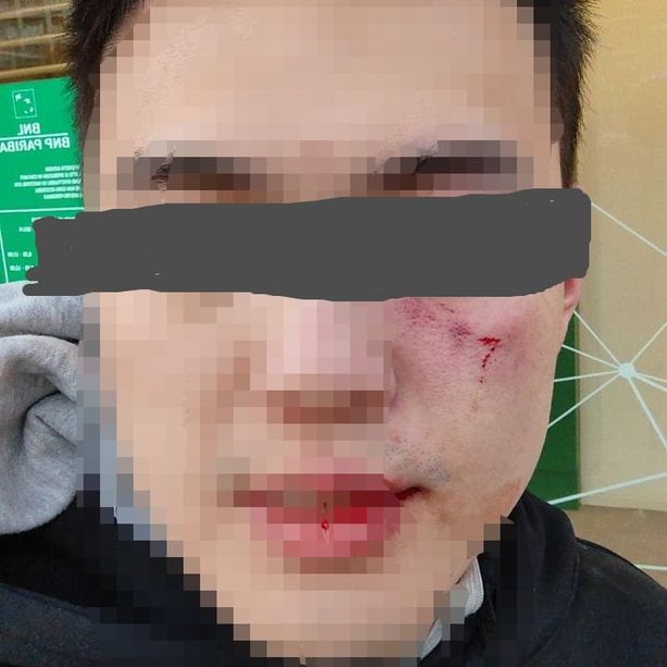 Studente universitario cinese aggredito e picchiato sulla metropolitana il giorno di Natale