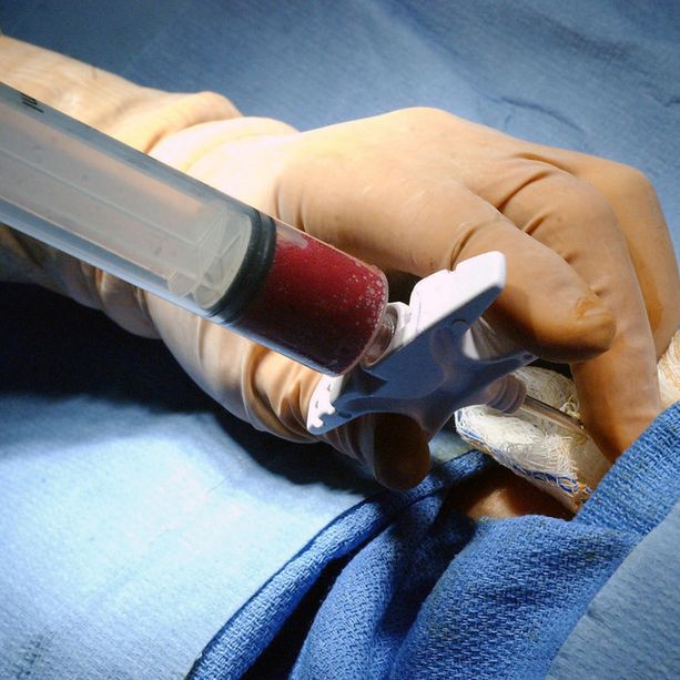 Rivoli, prima donazione di organi in Piemonte per il 2021: fegato e reni per salvare altre vite