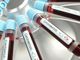 Coronavirus: 26 le persone risultate positive nelle ultime 24 nel genovese