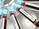 Coronavirus: in Liguria 259 nuovi positivi, 89 nel genovese