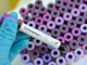 Coronavirus: 331 nuovi positivi in Liguria, 206 in provincia di Genova