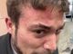 Colluttazione con gli agenti della polizia locale, c'è la versione del giovane: &quot;Scaraventato a terra, hanno cancellato il video della loro aggressione&quot;