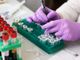 Coronavirus, in Liguria 149 nuovi positivi: 47 nel savonese