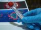 Coronavirus, sono 313 i nuovi positivi in Liguria dove non si arresta la crescita dei ricoveri