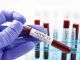 Coronavirus: 16 nuovi positivi in Liguria, 11 riguardano l'Asl 2 savonese
