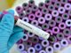 Coronavirus, sono 175 le persone contagiate in Piemonte