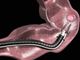 Nuova campagna europea per la prevenzione del tumore del colon e del retto