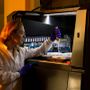 Botulismo in Italia: trend, dati e rischi legati alle conserve domestiche