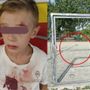 Sbatte contro la porta in ferro del campetto, bimbo di 8 anni al pronto soccorso [VIDEO]
