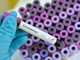 Coronavirus, 45 nuovi decessi e le vittime in Piemonte salgono a 662 Coronavirus, 45 nuovi decessi e le vittime in Piemonte salgono a 662