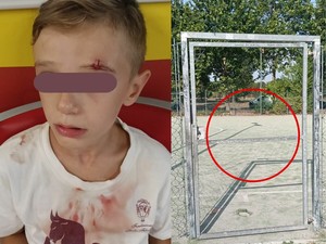 Sbatte contro la porta in ferro del campetto, bimbo di 8 anni al pronto soccorso [VIDEO]