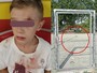 Sbatte contro la porta in ferro del campetto, bimbo di 8 anni al pronto soccorso [VIDEO]