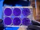 Altri due morti per il coronavirus nell'astigiano. Più positivi (45) che nuovi guariti (38) Altri due morti per il coronavirus nell'astigiano. Più positivi (45) che nuovi guariti (38)