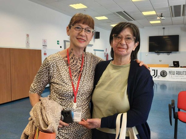 Ustionata da una fiammata, fa la volontaria al CTO: "Ho incontrato Elsa, era sorridente"