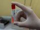 Coronavirus in Piemonte: 1548 nuovi positivi, la metà asintomatici. I ricoverati salgono a 125 Coronavirus in Piemonte: 1548 nuovi positivi, la metà asintomatici. I ricoverati salgono a 125