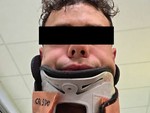Serata da incubo a Sanremo: 23enne cuneese rapinato e malmenato da un gruppo di otto ragazzi