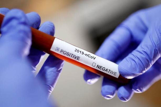 Coronavirus: un terzo dei tamponi fatti ma nella nostra provincia aumentano comunque i casi (478) Coronavirus: un terzo dei tamponi fatti ma nella nostra provincia aumentano comunque i casi (478)