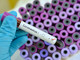 Ancora 23 morti per il coronavirus in Piemonte, ma calano sia i ricoveri che le terapie intensive