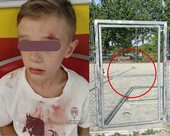 Sbatte contro la porta in ferro del campetto, bimbo di 8 anni al pronto soccorso [VIDEO]